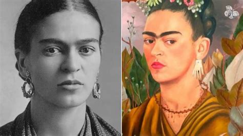 Investigadores Espa Oles Diagnostican El S Ndrome Que Sufr A Frida