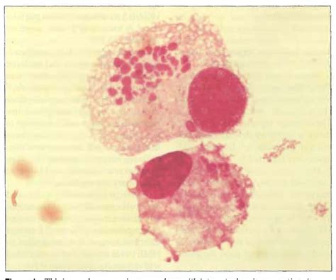 Figure From What Is New With Ehrlichiosis Semantic Scholar