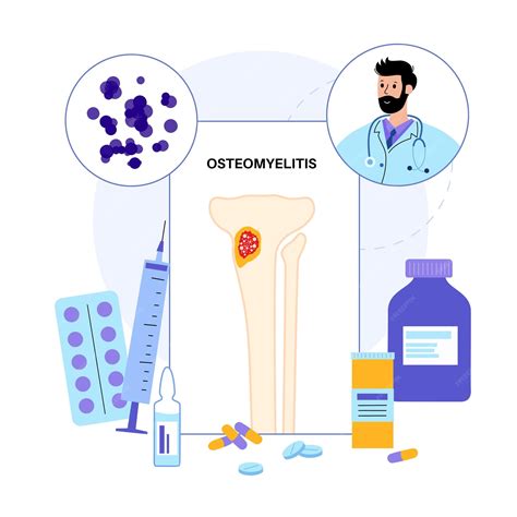 Enfermedad De Osteomielitis Huesos De Las Piernas Infectados