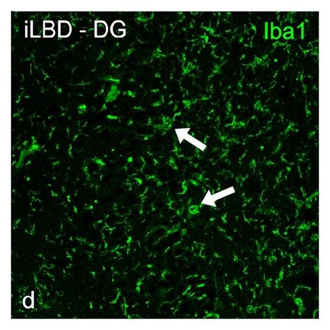 Colocalization Of The Majority Of Mcm Positive Cells With Iba In The