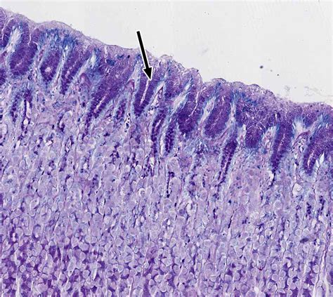 Pharynx, Esophagus, and Stomach | histology