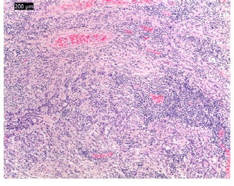 Light Micrographs Of Paraffin Embedded Section Stained With Hematoxylin