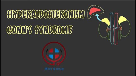 Hyperaldosteronism Conn S Syndrome Causes Pathophysiology