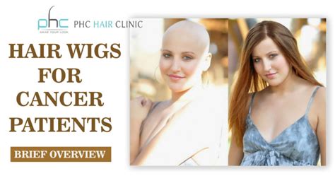 Hair Wigs for Cancer Patients : Overview on Cancer Patient Hair Wigs