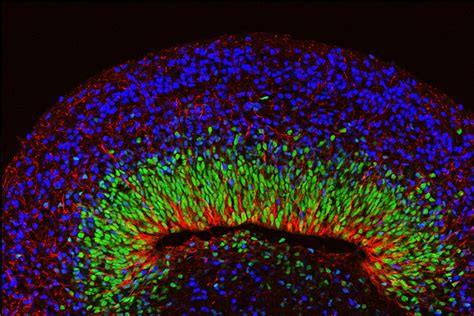 Organoids Electrical Activity Patterns Resemble Human Brain Tissue