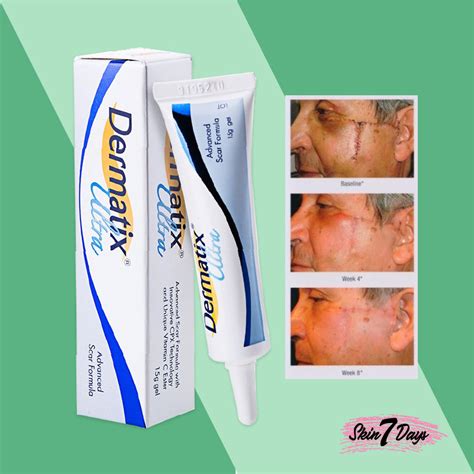 Dermatik Ultra Dermatic Dermatix Ultra Advanced Scar Formula Gel