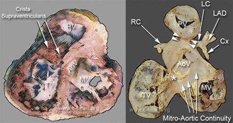 e-heart.org Cardiovascular Pathology Home Page