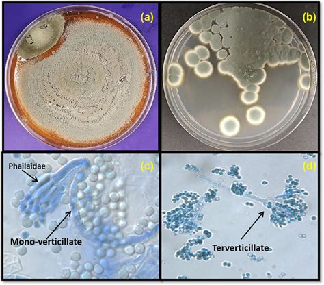 Ad Morphological Characteristics Of Penicillium Spp A And C