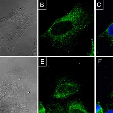 Perinuclear And Cytoplasmic Localization Of Pgis In Hk Cells Hk Cells