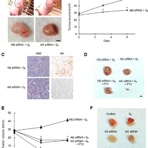 Rnai Mediated Akt Downregulation Inhibits Ovarian Cancer Cell Growth In