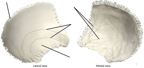 Parietal (right) Diagram | Quizlet