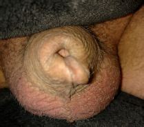 Circumcised Penis Porn Pictures Xxx Photos Sex Images Pictoa