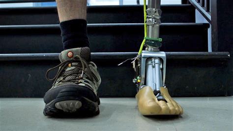 Smart prosthetic ankle can adapt to uneven ground