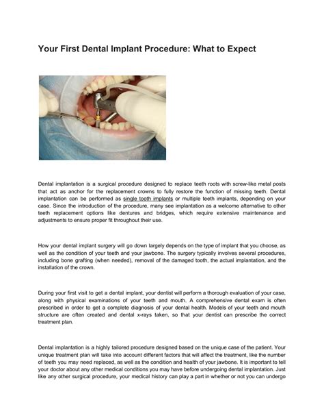 Ppt Your First Dental Implant Procedure What To Expect Powerpoint