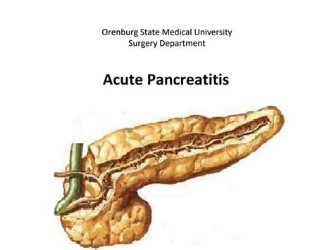 Acute Pancreatitis Diagnosis And Treatment Ppt