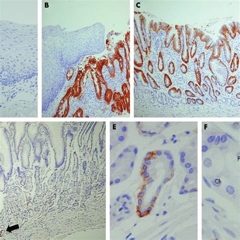 Epcam Immunohistochemistry Performed On A Normal Oesophageal Mucosa