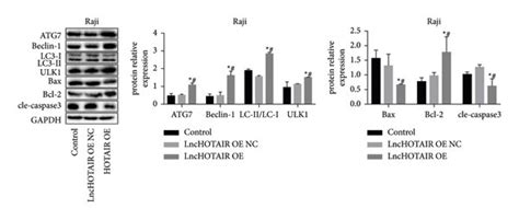 Western Blotting Results Of Autophagy And Apoptosis Related Proteins In Download Scientific