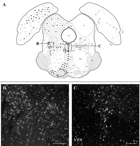 A Section At The Level Of The Deep Nuclei Of The Cerebellum B