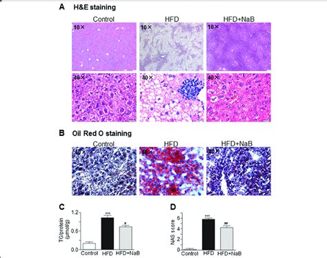 Nab Alleviated Hfd Induced Steatohepatitis In Mice A He Staining Of