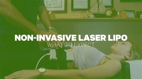 Laser Lipo What To Expect Youtube