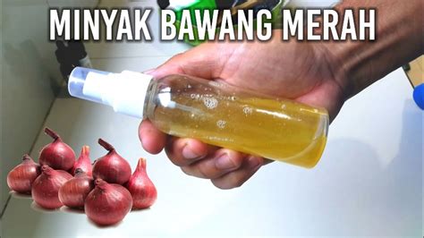 Diy Cara Membuat Minyak Bawang Merah Untuk Menghilangkan Ketombe Dan