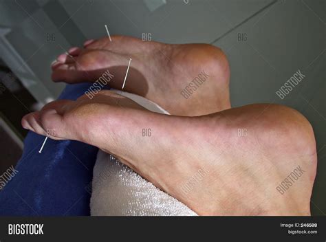 Needles Feet Image And Photo Free Trial Bigstock