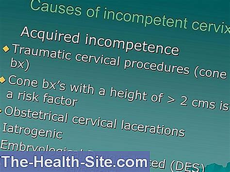 Cervical Insufficiency Risks Causes Symptoms Treatment 💊 Scientific