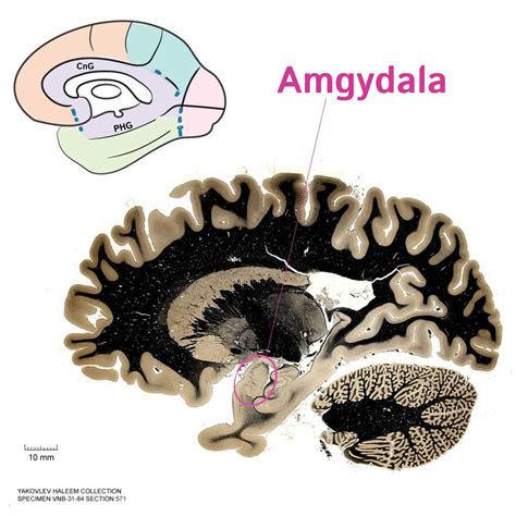 Neuroanatomy Glossary: Amygdaloid body | Draw It to Know It