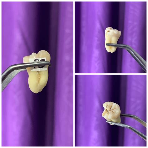 Jual Jual Gigi Praktikum Molar Atas Bawah Gigi Asli Shopee Indonesia