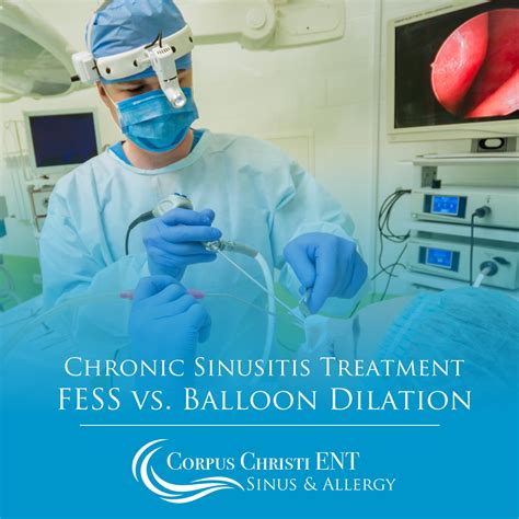 Chronic Sinusitis Treatment Fess Vs Balloon Dilation Corpus Christi