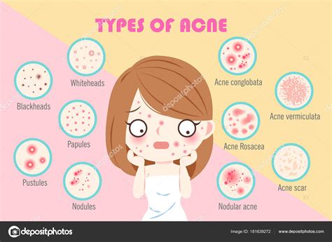 The Difference Between A Zit And A Pimple Difference Between Zit And Pimple With Table