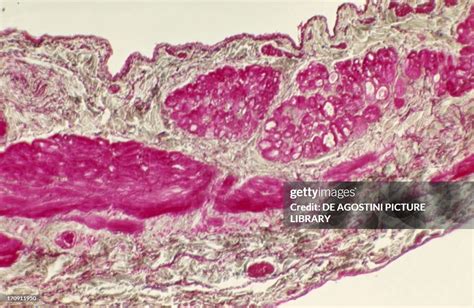 Cross Section Of A Human Inferior Vena Cava Seen Under A Microscope