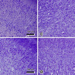 Representative Light Microscopic Photomicrographs Of Rat Brain Belong