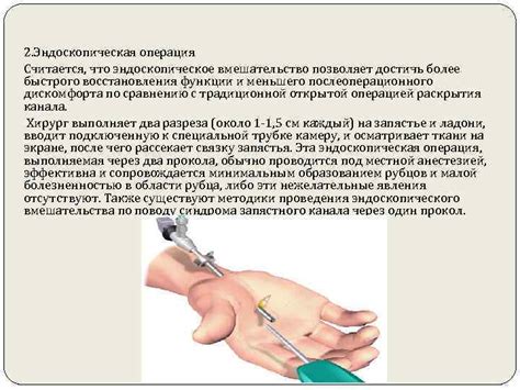Карпо-карпальный синдром тонельный синдром Выполнил студент 5 курса