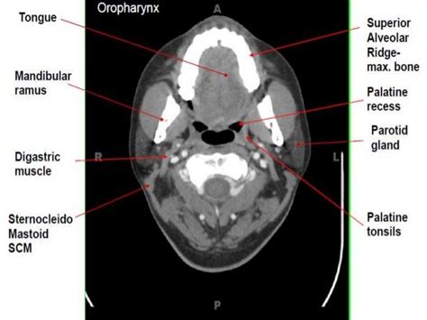 Ct Anatomy Neck - Anatomical Charts & Posters