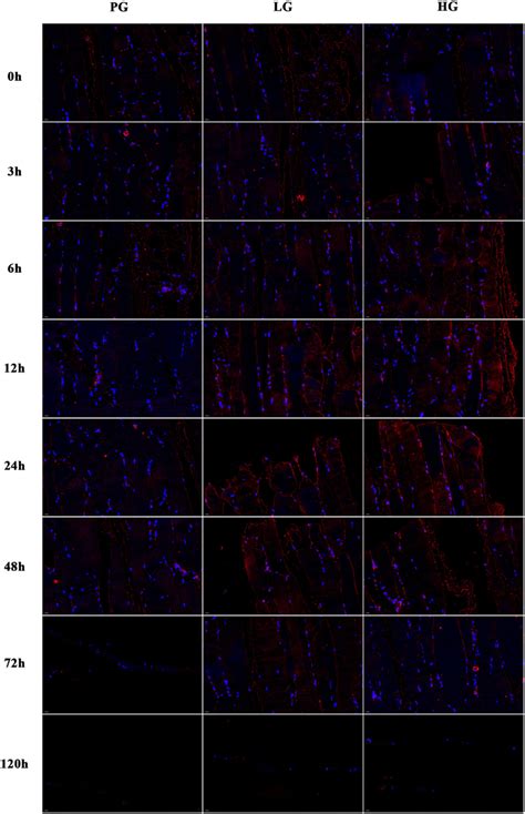 Apparent change of HIF1α by fluorescence double staining method for 0