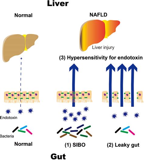 Frontiers Endotoxins And Non Alcoholic Fatty Liver Disease