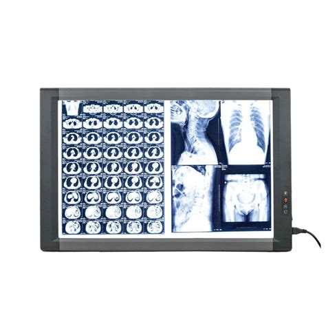 Digital X Ray Film Viewer Mg Nanchang Micare Medical Equipment