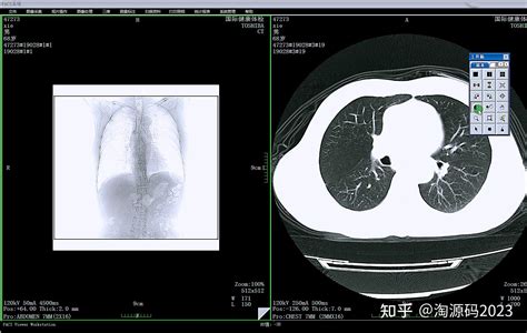 C 开发工具实现三维重建ct医学影像pacs系统 知乎