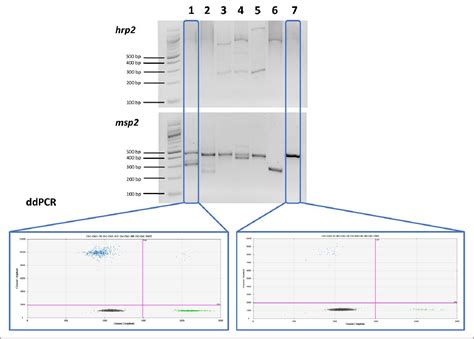 Figure From High Throughput Plasmodium Falciparum Hrp And Hrp Gene