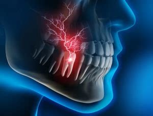 SYMPTOMS OF RCT | Dr Malu's Dental & Maxillofacial Clinic