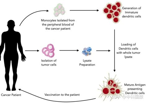这是细胞治疗的时代盘点12种免疫细胞疗法 知乎