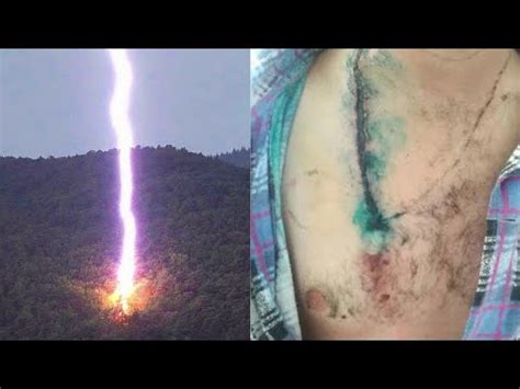 10 People Who Got Struck By Lightning YouTube