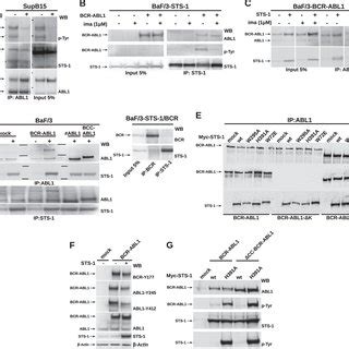 Sts 1 Negatively Regulates Bcr Abl Dependent Leukemogenesis And Cell