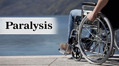 Paralysis Symptoms Causes Diagnosis Treatment Prevention