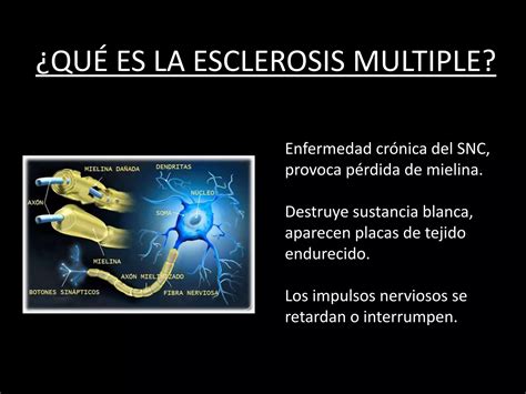 Esclerosis Multiple Ppt Descarga Gratuita