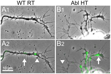 A1B1 Phase Contrast Images Of Phase Dark Nodules And Phase Light