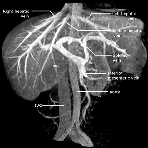 Index Of Dept Radiology Radiologysite Images Med Students 11 Liver