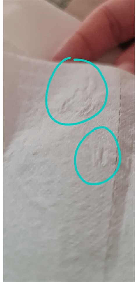 nasal drainage rnasalpolyps