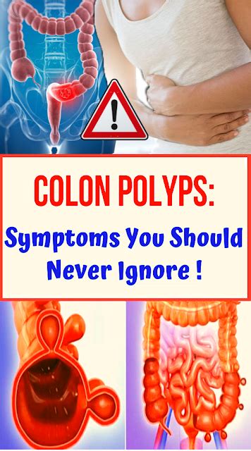 Colon Polyps Symptoms You Should Never Ignore Wellness Magazine